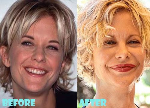 Meg Ryan